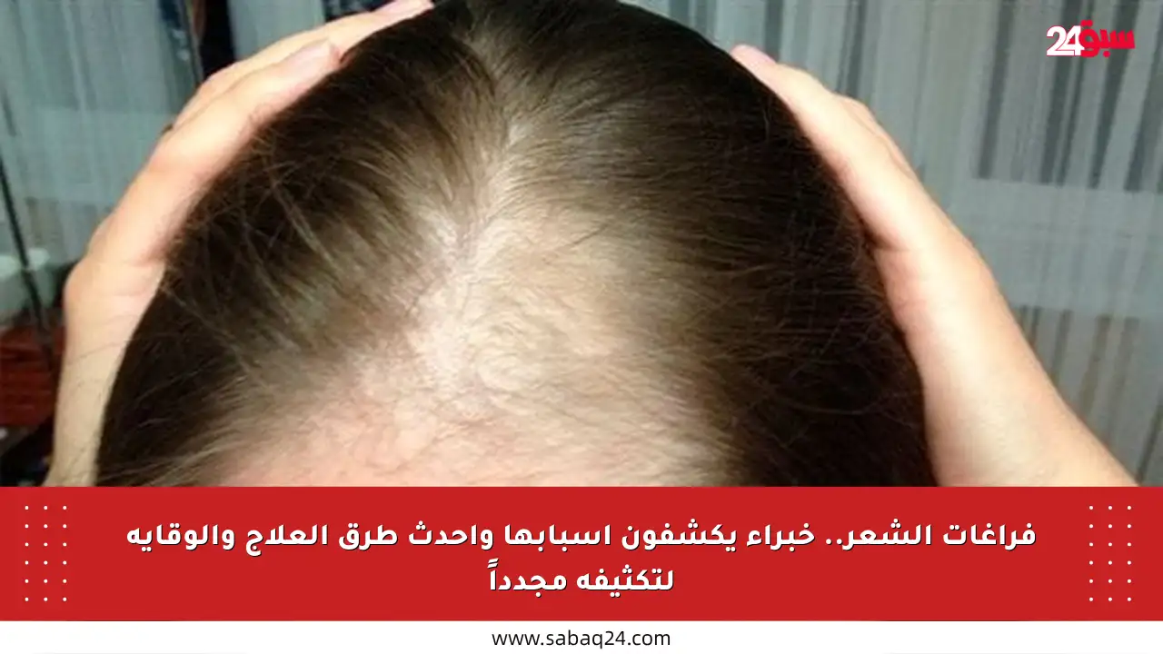 فراغات الشعر.. خبراء يكشفون أسبابها وأحدث طرق العلاج والوقاية لتكثيفه مجدداً